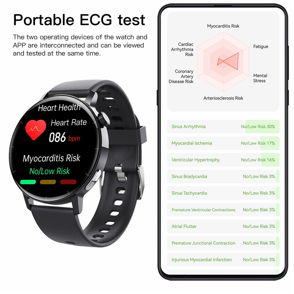 SmartWatch F67 Pro ECG